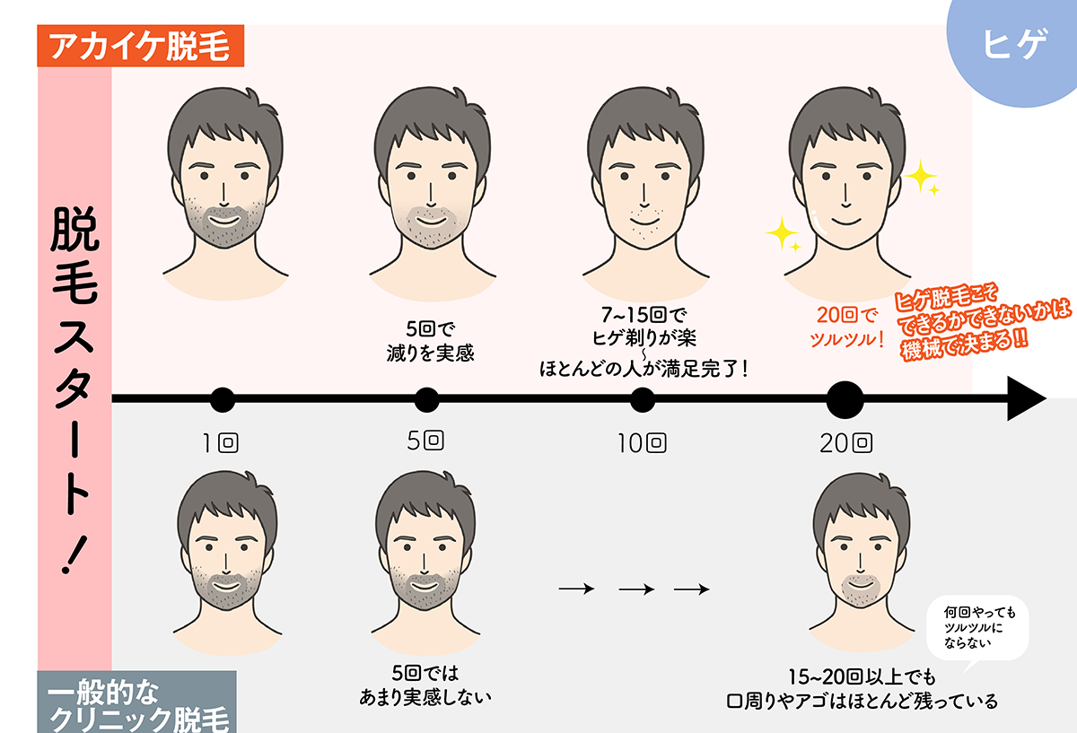 徳島 ヒゲ脱毛 Men S Asc 男性専用メディカルケア